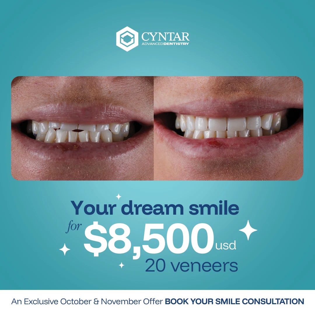Supplied smile makeover opening promotion with before-and-after photographs