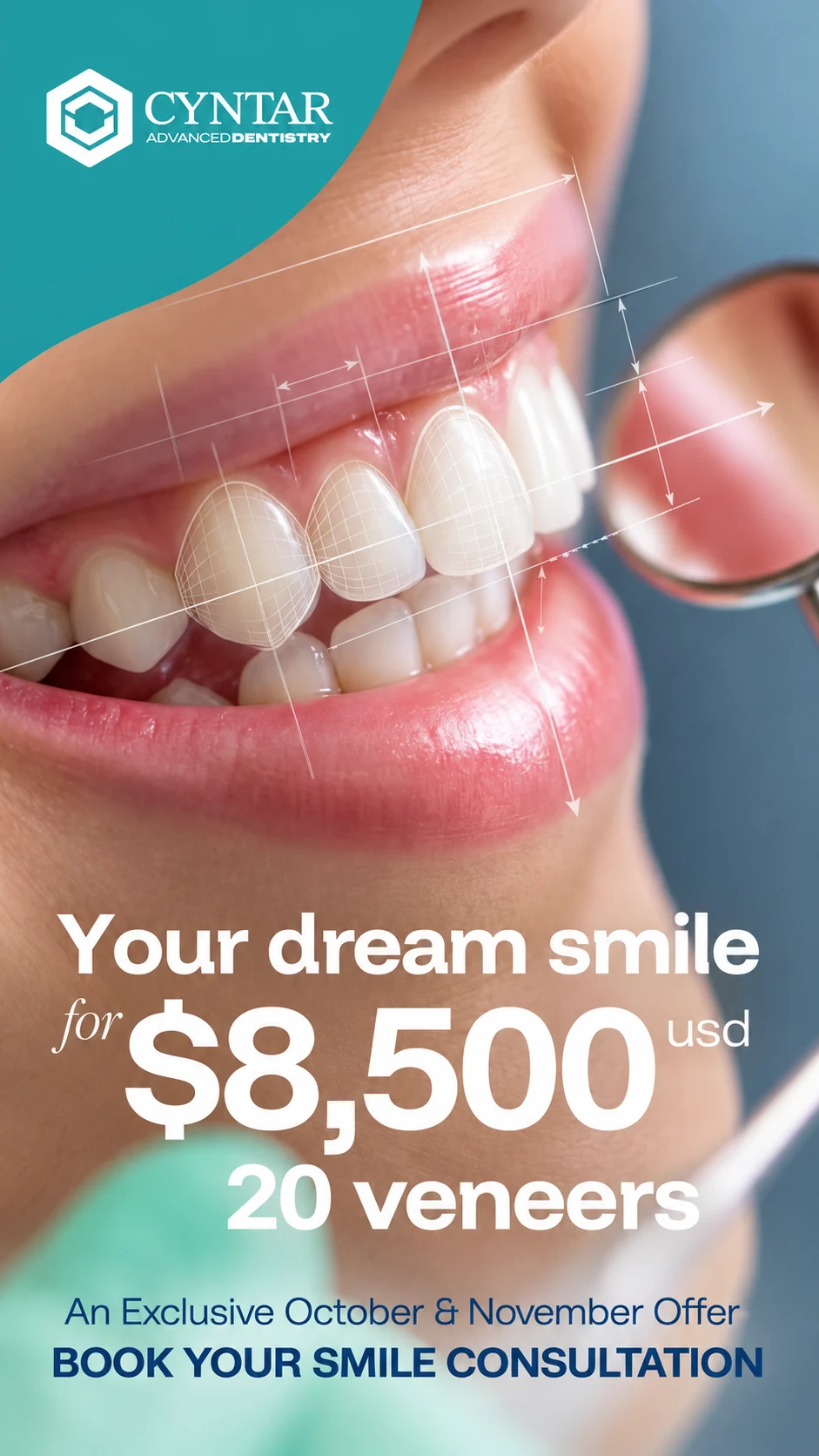Supplied 20-veneer opening promotion with veneer illustrations