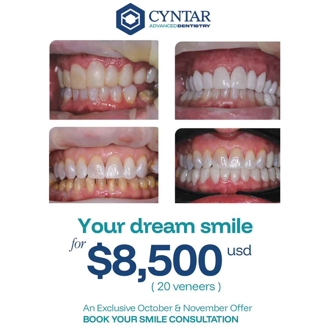 Supplied smile makeover opening promotion with four smile photographs