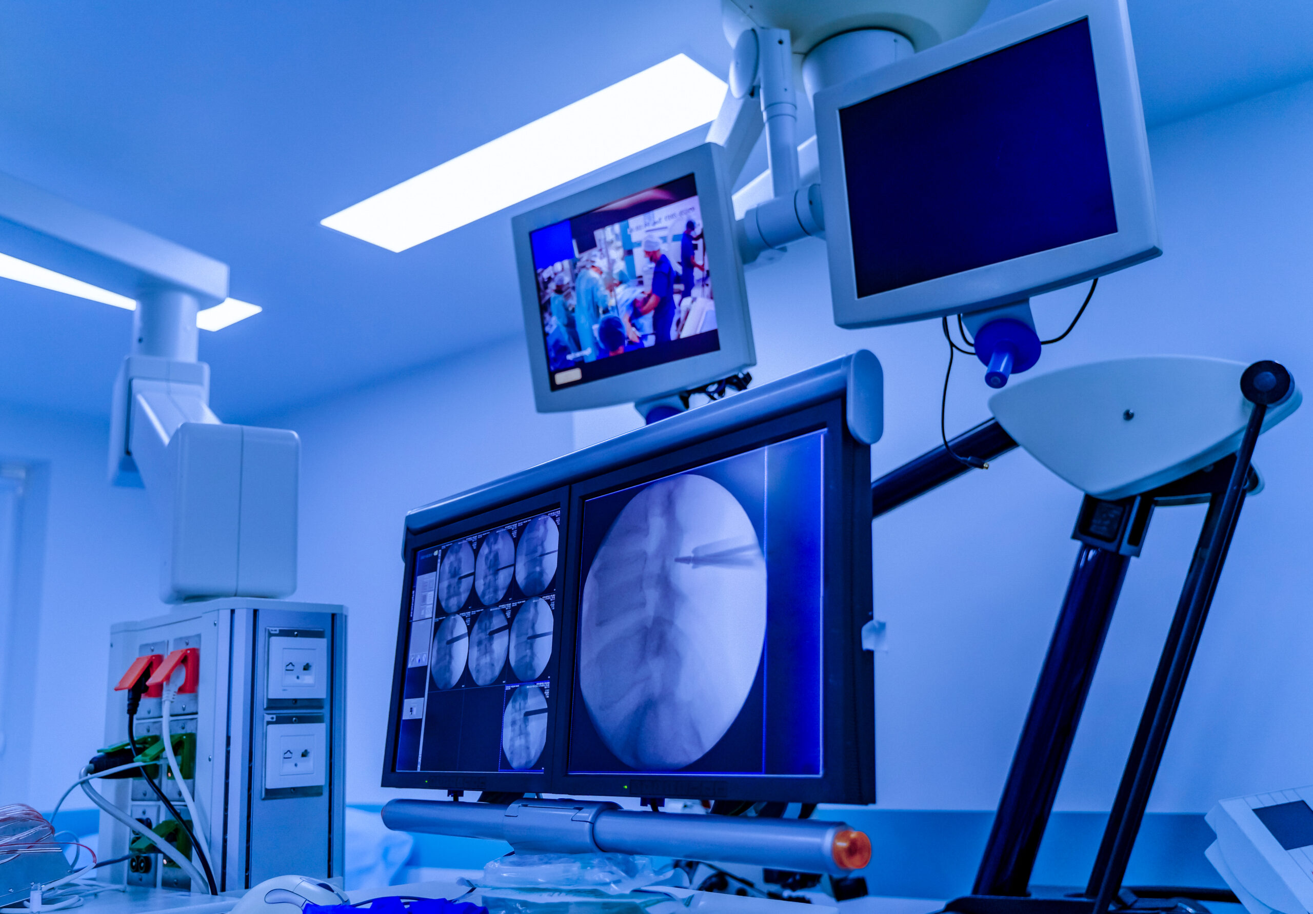Modern equipment in operating room. Spine Surgery. Group of surgeons in operating room.