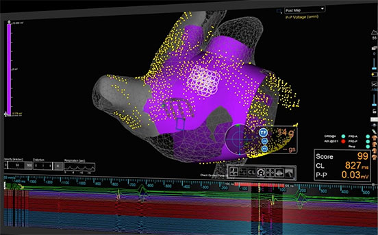 ep-campaign-ensite-x-mapping-2